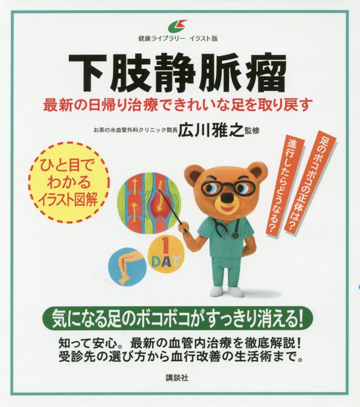 下肢静脈瘤　最新の日帰り治療できれいな足を取り戻す　　（健康ライブラリー　イラスト版）