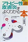 アトピー性皮膚炎がよくわかる本　こうすれば長引かない、早くよくなる　　（名医登場シリーズ）