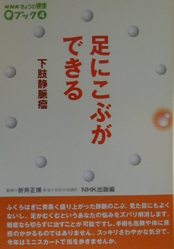 足にこぶができる下肢静脈瘤　　（ＮＨＫきょうの健康Ｑブック　４）