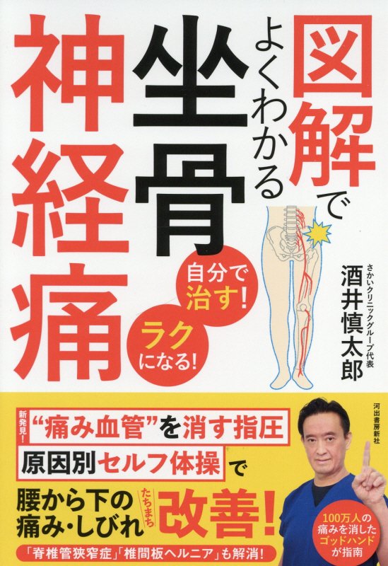 図解でよくわかる坐骨神経痛　自分で治す！ラクになる！　