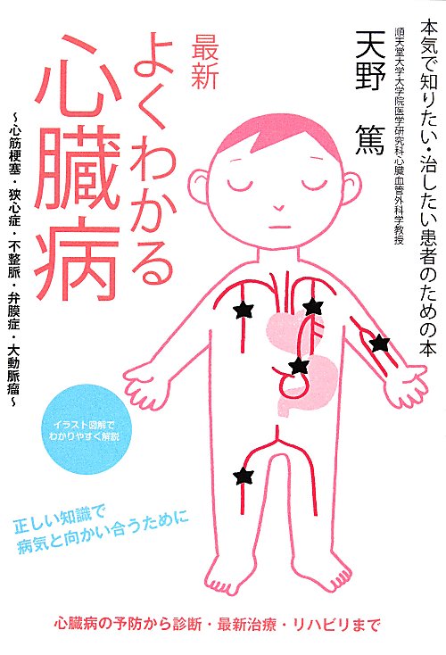 最新よくわかる心臓病　心筋梗塞・狭心症・不整脈・弁膜症・大動脈瘤　
