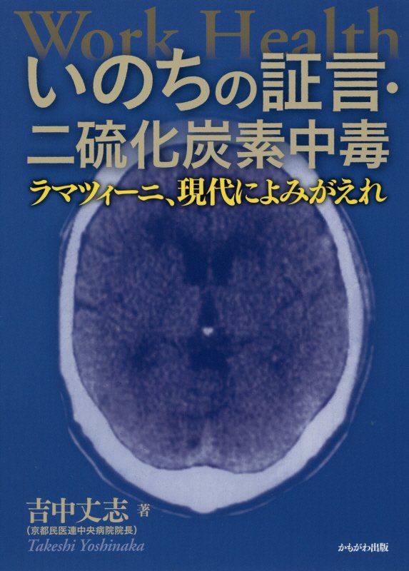 いのちの証言・二硫化炭素中毒　ラマツィーニ、現代によみがえれ　