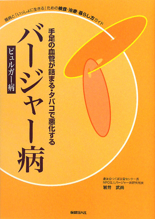 バージャー病（ビュルガー病）　手足の血管が詰まる・タバコで悪化　　（難病と「いっしょに生きる」ための検査・治療・暮らし方