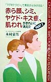 赤ら顔、シミ、ヤケド・キズ痕、肌われがきれいに消えた　ＰＡＲ　　（ムックの本　６３４）