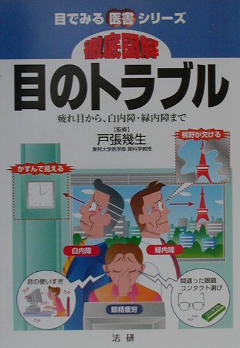 徹底図解目のトラブル　疲れ目から、白内障・緑内障まで　　（目でみる医書シリーズ）