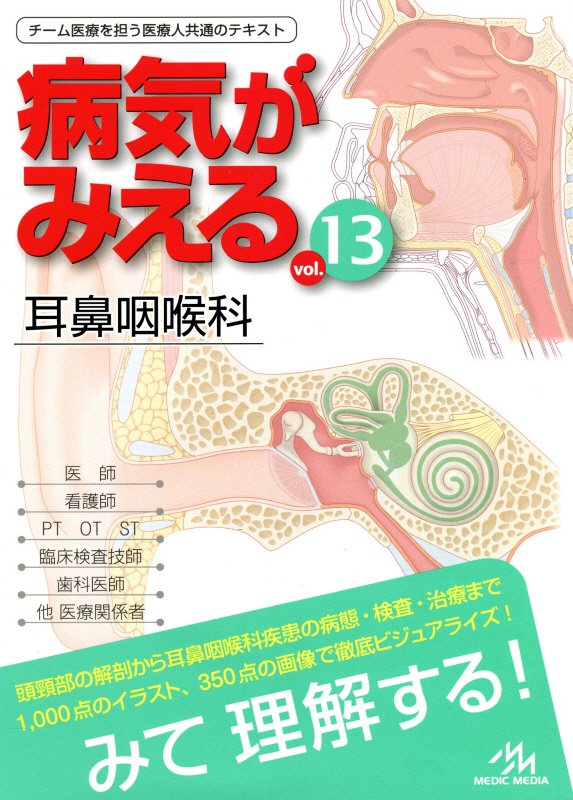 病気がみえる　ｖｏｌ．１３　耳鼻咽喉科